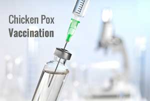Shingles reported at Chicken pox vaccination site in some children
