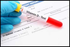 When do you really need Vitamin D Tests ?