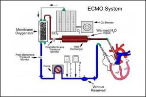 Minor girl braves ECMO procedure, gets new lease of life