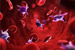 No need to treat Isolated mild/moderate thrombocytopenia : Study