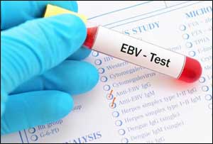 Epstein-Barr virus causes 7 serious diseases : Study
