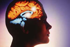 Migraine linked to higher risk for stroke, MI