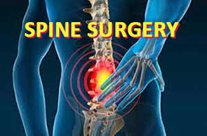 Preoperative Opioid use worsens Spine Surgery outcomes