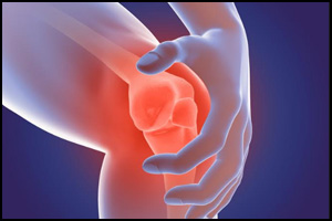 Latest DMARD safety guidelines in inflammatory arthritis by BSR