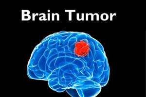 Minimally Invasive Technique to burn away brain tumour Cells