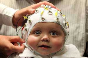 EEG Provide Early, Accurate Prediction of Autism in Infants