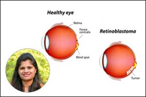 Retinoblastoma: Curable cancer in children