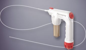 Hemospray stops GI bleeding in 95% of patients within five minutes