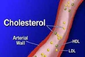 PCSK9 inhibitors beneficial for patients with high lipoprotein(a) levels