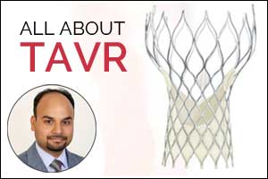 TAVR- The disruptive cardiovascular advancement entire world is talking about