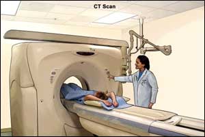 Dual-energy CT as good as MRI for diagnosing wrist fractures