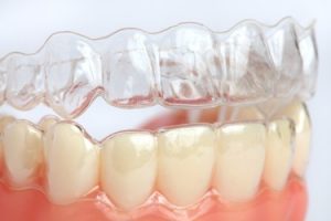 Helping dental retainers and aligners fight off bacteria