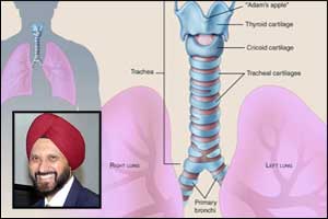 From aorta to trachea: Feasibility of bioengineered tracheal and bronchial reconstruction using stented aortic matrices