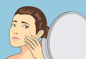 Zinc has a role in acne treatment
