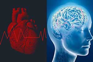 Expert consensus on cognitive function and arrhythmias