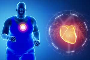Weight loss can reverse atrial fibrillation in obese patients