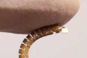 Smart Stent that guards against Restenosis