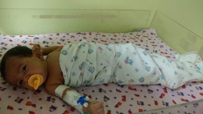 Doctors remove Injection needle That remained in body of a neonate for 20 days