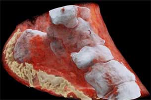 Scientific Marvel- First 3-D Colour X-Ray for diagnosing Diseases