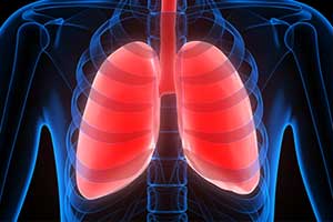 People with diabetes at increased risk for restrictive lung disease