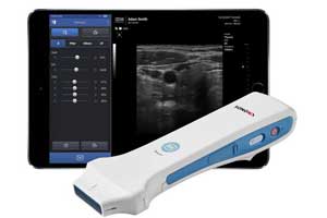 Handheld, Wireless Ultrasound Device Now Available