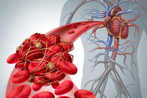 NOACs superior to vitamin K antagonists in early stage CKD