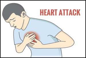 Siblings of Rheumatoid Arthritis patients at high risk of Heart Attack