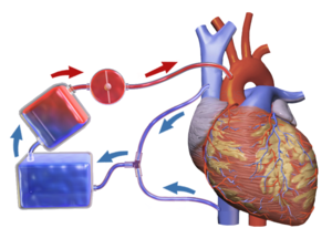 Intraoperative Autologous blood  transfusion benefits children in  cardiac surgeries