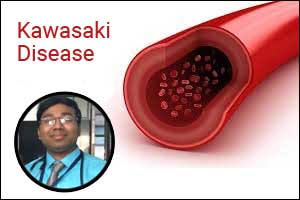 New technique for diagnosing Kawasaki Disease- Dr Manojit Mondal