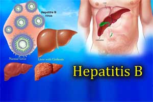 A new antiviral drug for treating Hepatitis B on fast track