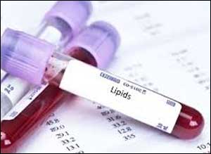 One third of people with normal Lipid tests at high risk of CVD : SRL analysis