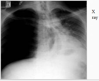 Chest X Ray imaging on rise in ED despite CT availability