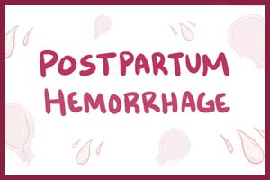 WHO updates guidance to prevent postpartum haemorrhage