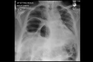 Artificial Intelligence can quickly and accurately report Chest X-Rays
