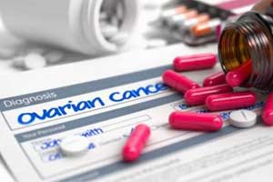 Newer contraceptives reduce ovarian cancer risk in women: BMJ