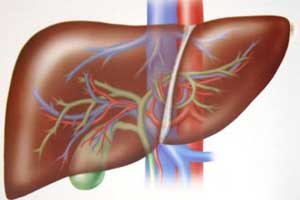 Terlipressin more effective than noradrenaline in patients with hepatorenal syndrome