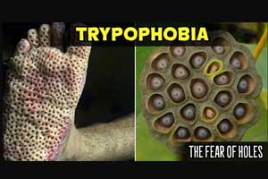 Gabapentin can lead to Trypophobia in some patients