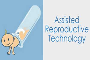 Unsuccessful assisted reproduction cycles increase risk of PE