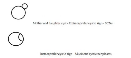 “Extracapsular Cystic” Sign identifies pancreatic serous cystic neoplasms: Dr Niharika Prasad