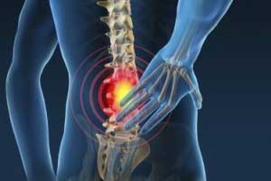 New nerve stimulation therapy effective for refractory back pain