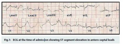 Aluminum Phosphide poisoning may present as Heart attack