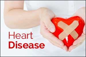 Cardiac MRI promising tool to detect heart disease early in women