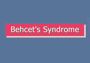 Indian doctors report an unusual cause of fever: Behcet syndrome