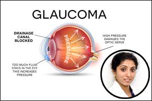 Glaucoma -The sneak thief of vision!