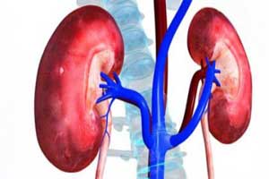 Heart failure patients at high risk of developing kidney failure