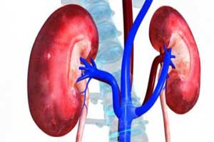 RML doctors remove world’s heaviest kidney tumour