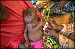 91% of children in India battle against malnutrition- NITI Aayog