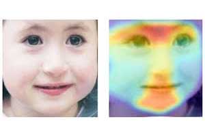 Rare genetic disorders detected by a face photo : AI Technology
