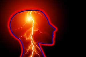 Psychotherapy May Reduce Frequency of Nonepileptic Seizures