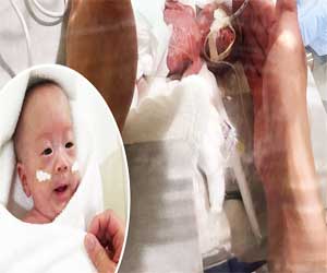 WOW: Smallest Baby boy in the world, weighing just 268 grams, born in Japan